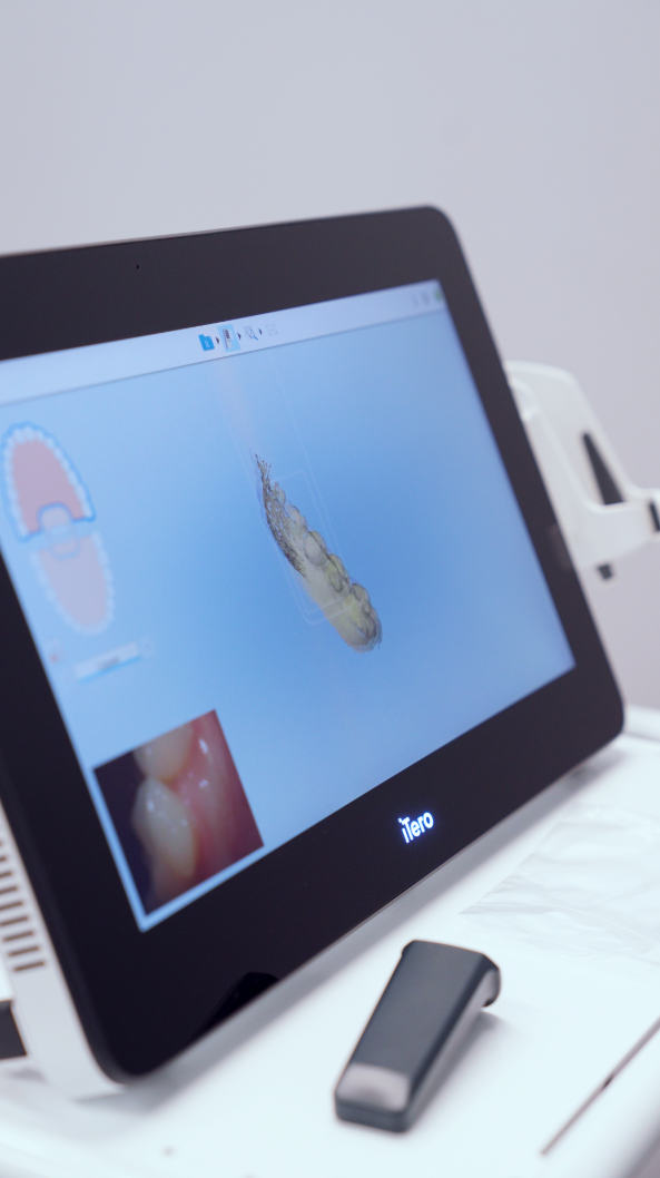 how-to-choose-an-orthodontist-in-san-jose