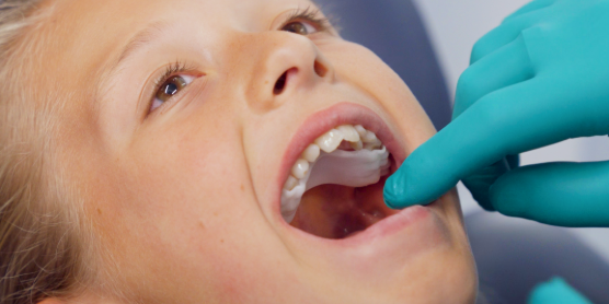 when-should-my-child-first-see-an-orthodontist