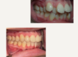 when-should-my-child-first-see-an-orthodontist