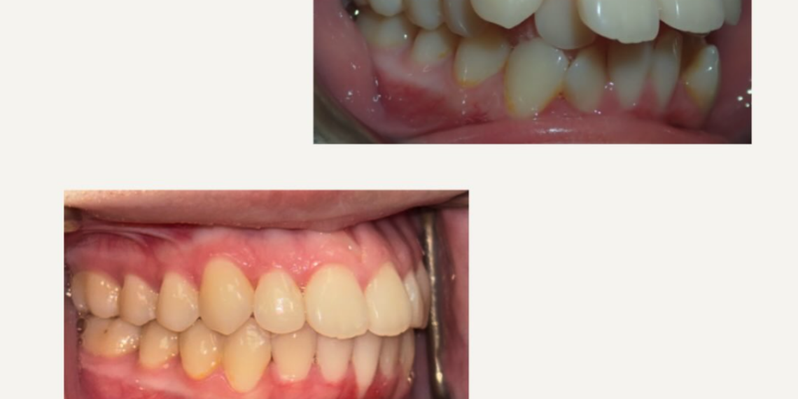 when-should-my-child-first-see-an-orthodontist
